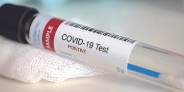Pressure groups raise hue and cry over Covid test cost, East Garo DC clarifies