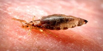 Scrub Typhus disease in Noklak district of Nagaland
