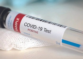 Covid test: Govt promises to ease hardships of entrants