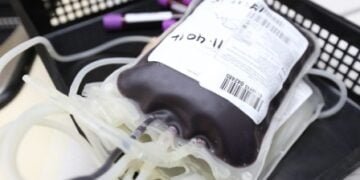 Plasma screening camp
