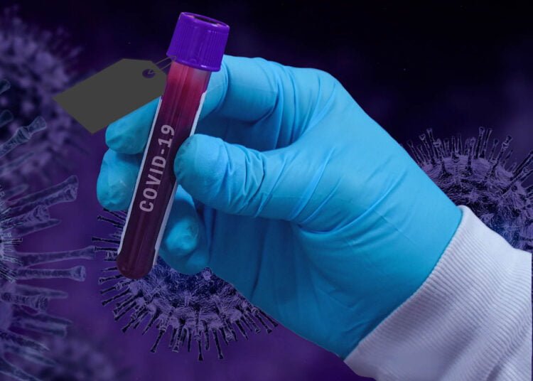 Covid-19 tests at NEIGRIHMS price tagged