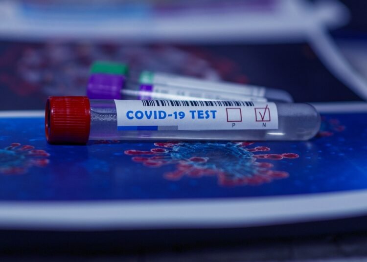 Exemption from Covid tests for VVIP outsiders scrapped