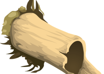 Student dies in freak accident