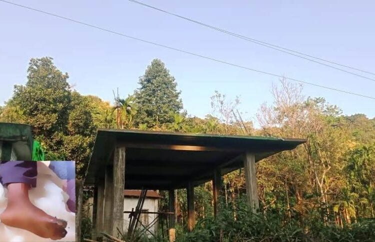 7-year-old boy sustain injuries after electric shock