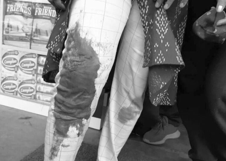 Daylight robbery: Biker thieves steal Rs 3 lakh in cash from woman