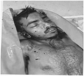 Man dies in suspected case of hit-and-run