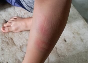 Woman accuses Judo trainer of brutally beating her son