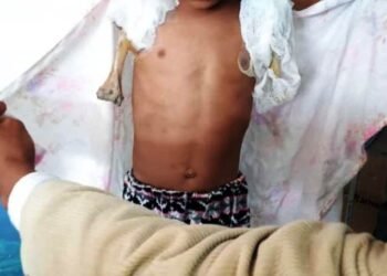 KSU demands compensation for electrocuted child