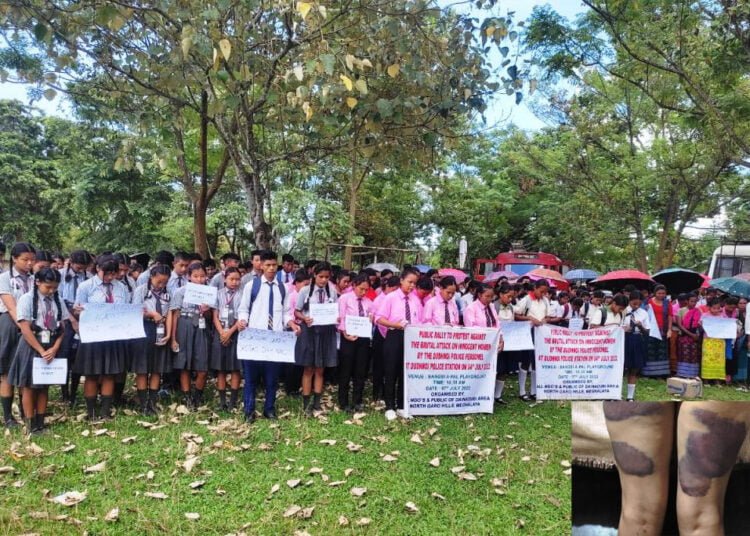 Organisations hold protest rally against ‘assault’ on Garo woman