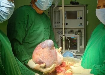 Williamnagar doctors remove 7 kg tumour from patient
