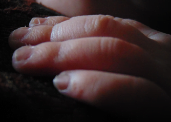 Newborn found dumped with multiple bite marks