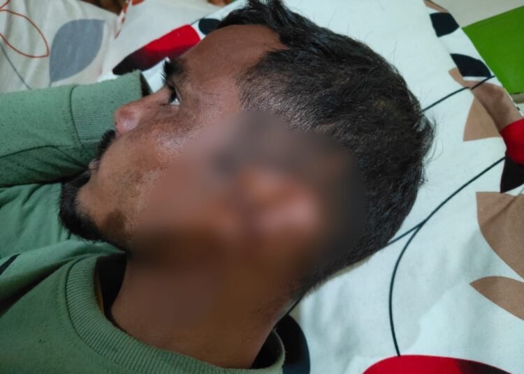 Headman, secretary attacked with axe in EJH village