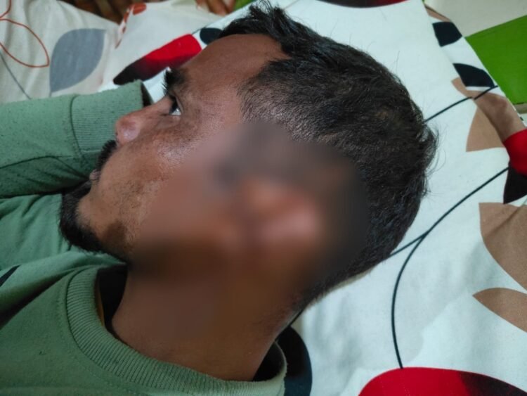 Headman, secretary attacked with axe in EJH village