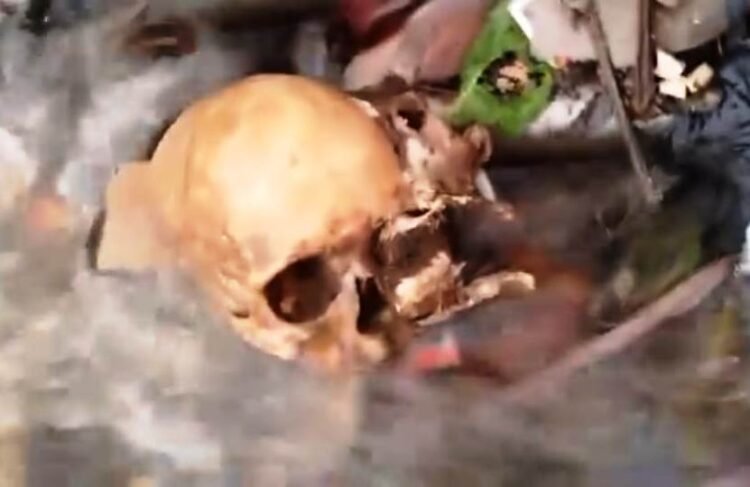Dismembered body parts found in City drain