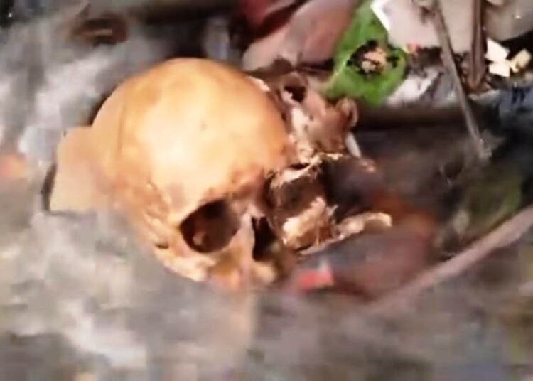 Dismembered body parts found in City drain