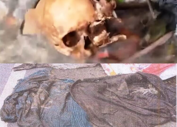 Police still clueless over severed body found in city drain