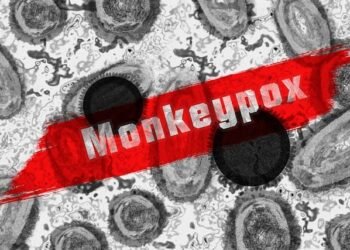 Meghalaya health dept issues advisory for monkeypox