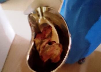 Doctor accused of leaving bandage inside patient’s abdomen post surgery