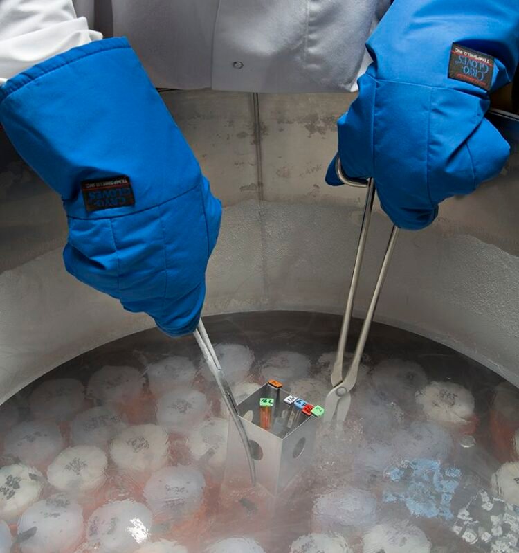Preserving Fertility for the Future- Freezing Eggs