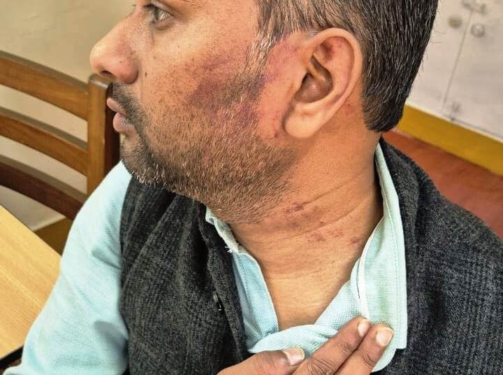 NEHU Hindi professor assaulted by five men led by student leader; probe ordered