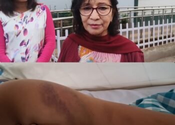 Years of domestic violence leave woman in hospital