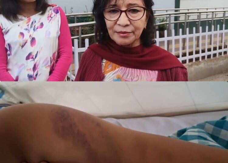 Years of domestic violence leave woman in hospital