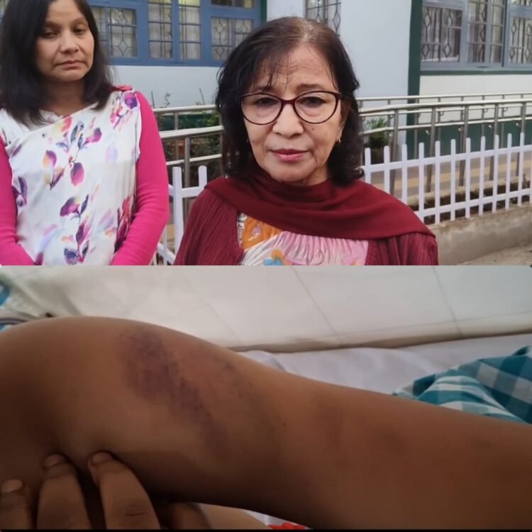 Years of domestic violence leave woman in hospital