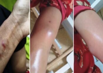Meghalaya woman assaulted by employer in Nagpur, EKH SP reaches out
