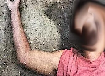 Man dies of suspected drug overdose