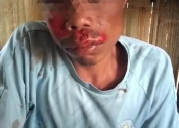 Lapangap man injured in slingshot attack