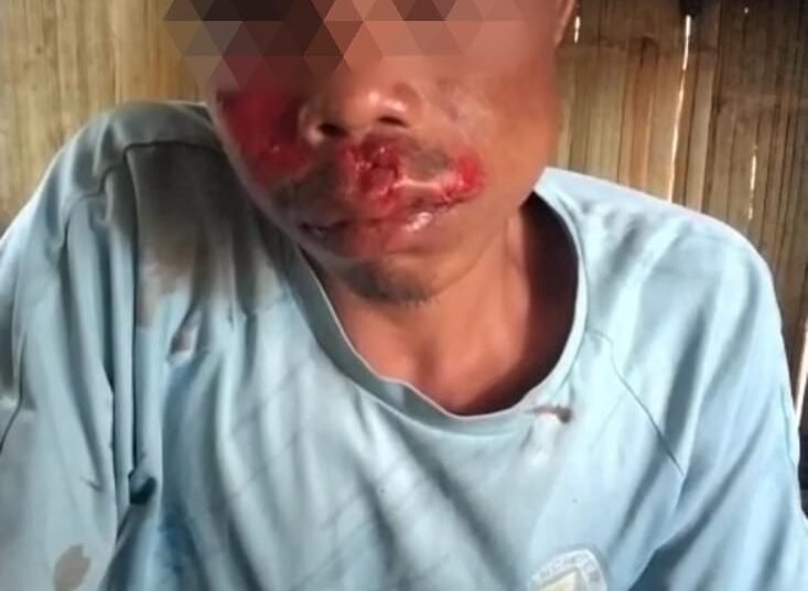 Lapangap man injured in slingshot attack