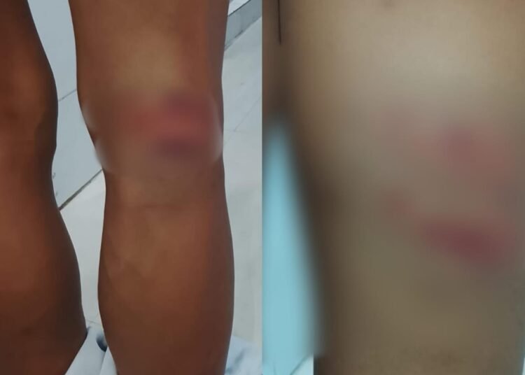 19-year old youth tortured inside Sohra PS, probe ordered