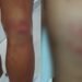19-year old youth tortured inside Sohra PS, probe ordered