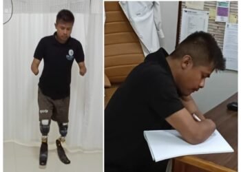 An electric shock produces Meghalaya’s first blade runner