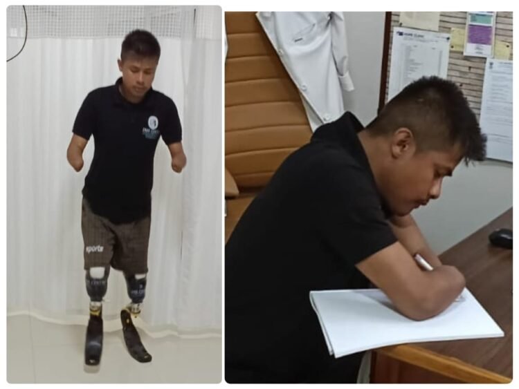 An electric shock produces Meghalaya’s first blade runner