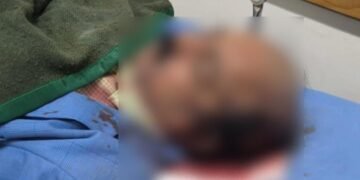 NEHU Registrar in-charge attacked by masked men