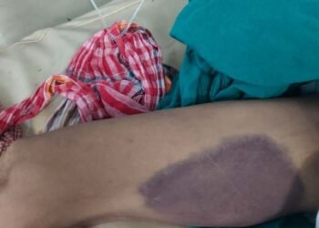 Allegations of custodial torture in bike theft case