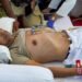 Govt ‘cruel’ for ignoring Wangchuk’s fast, says Dipke, as activist enters Day 18 of hunger strike