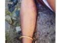 Unidentified male body found near Khanapara petrol pump