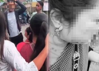 Drug user detained for ripping gold earrings off woman in City
