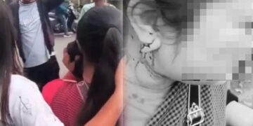 Drug user detained for ripping gold earrings off woman in City