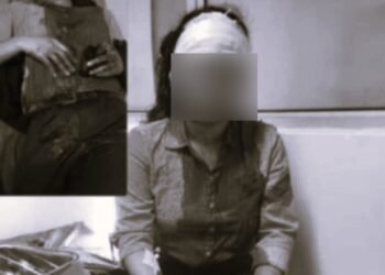 Woman stabbed in neck for phone, 15 days after daylight earring loot