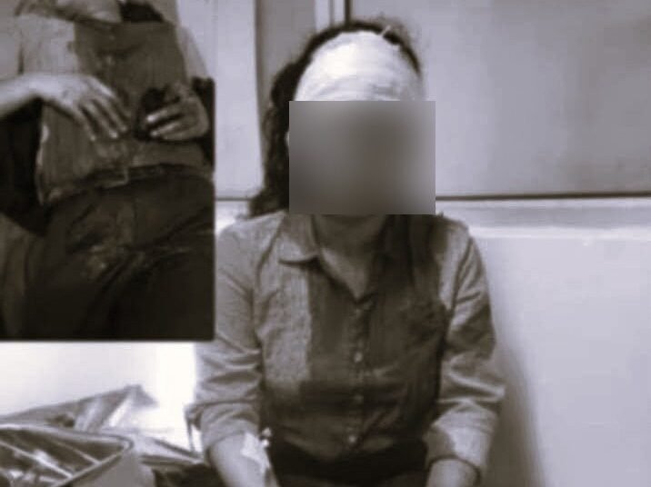 Woman stabbed in neck for phone, 15 days after daylight earring loot